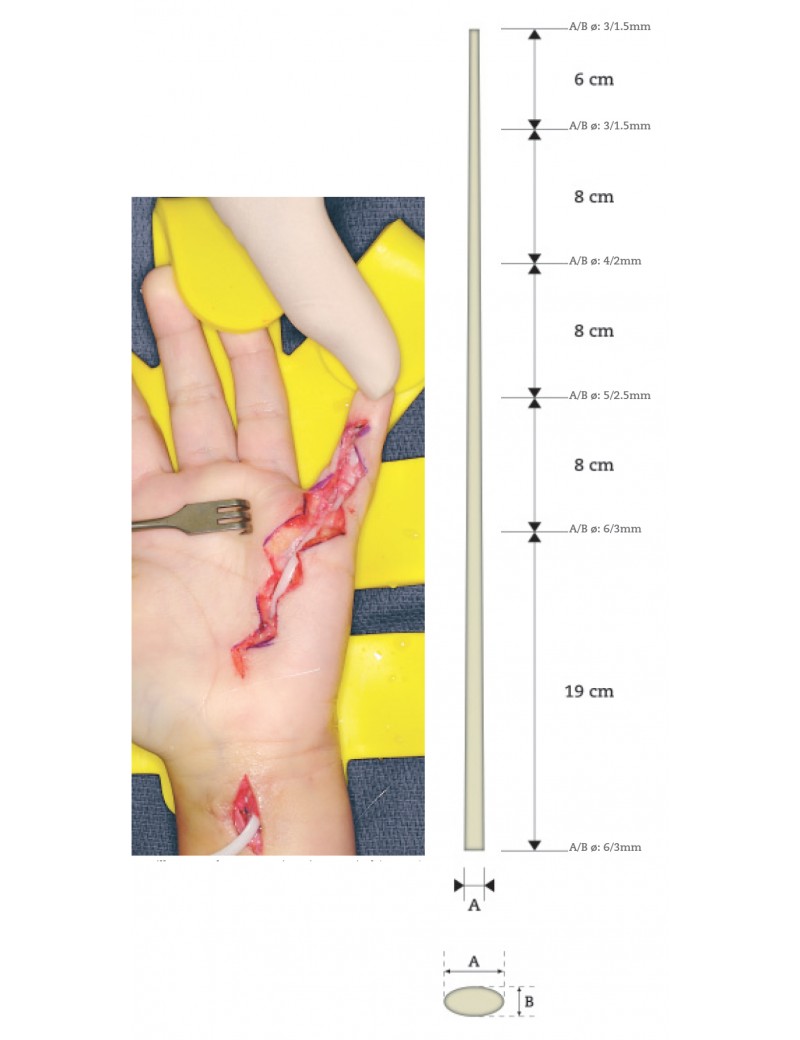 Universal Tendon spacer